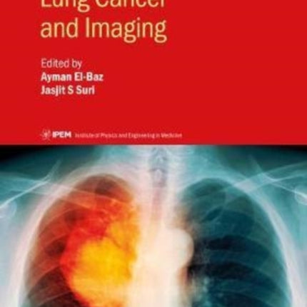 Lung Cancer and Imaging