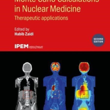 Monte Carlo Calculations in Nuclear Medicine