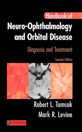 Handbook of Neuro-Ophthalmology: Diagnosis & Treatment