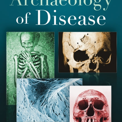 The Archaeology of Disease: Third Edition