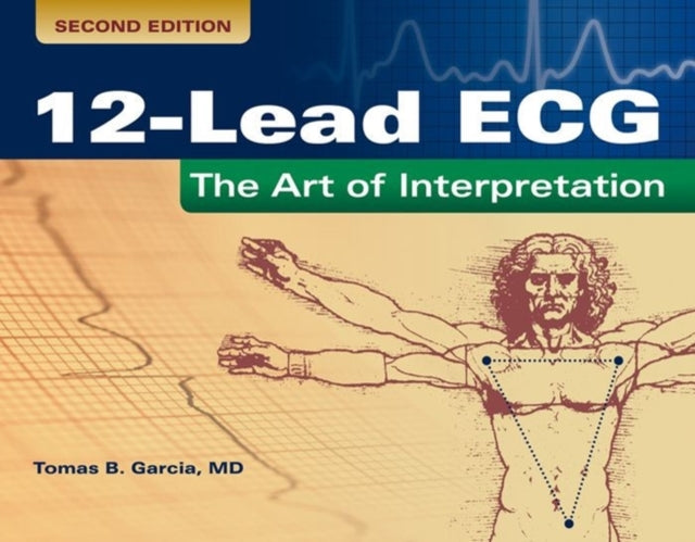 12-Lead ECG: The Art Of Interpretation