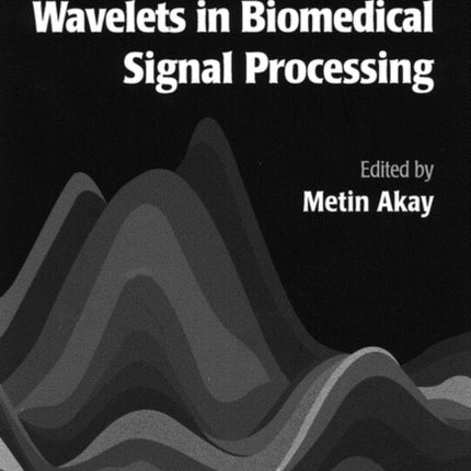 Time Frequency and Wavelets in Biomedical Signal Processing