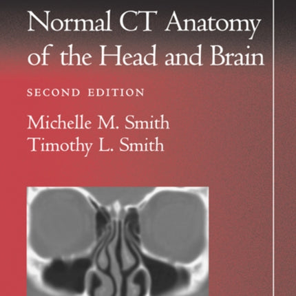 Pocket Atlas of Normal CT Anatomy of the Head and Brain