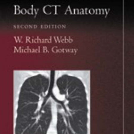 Pocket Atlas of Body CT Anatomy