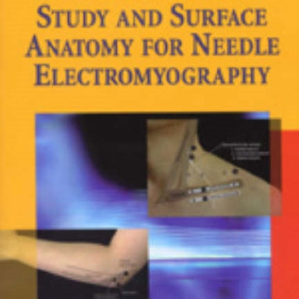 Manual of Nerve Conduction Study and Surface Anatomy for Needle Electromyography