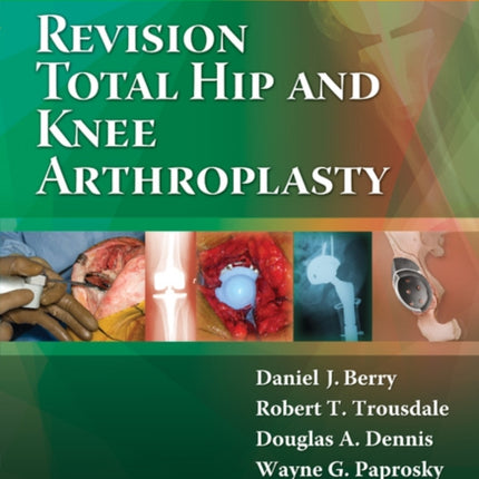 Revision Total Hip and Knee Arthroplasty