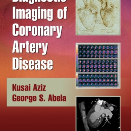 Diagnostic Imaging of Coronary Artery Disease