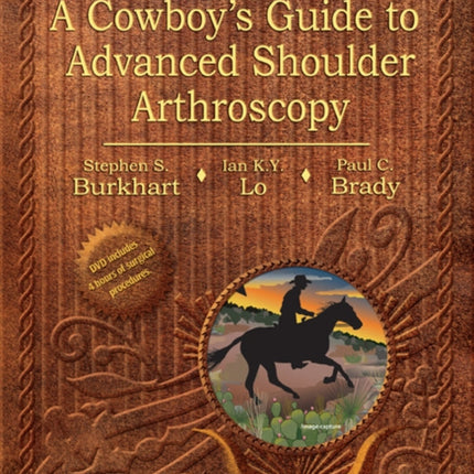 Burkhart's View of the Shoulder: A Cowboy's Guide to Advanced Shoulder Arthroscopy