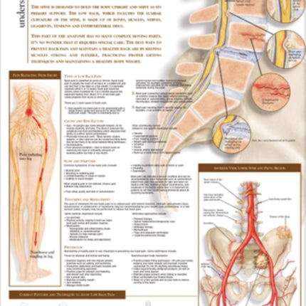 Understanding Low Back Pain Anatomical Chart