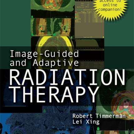 Image-Guided and Adaptive Radiation Therapy