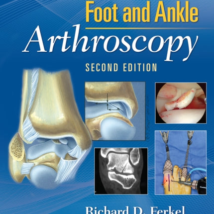 Foot & Ankle Arthroscopy