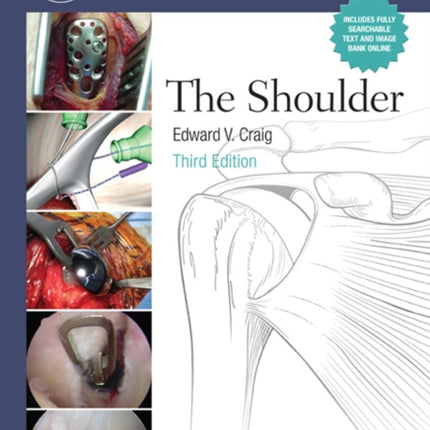 Master Techniques in Orthopaedic Surgery: Shoulder