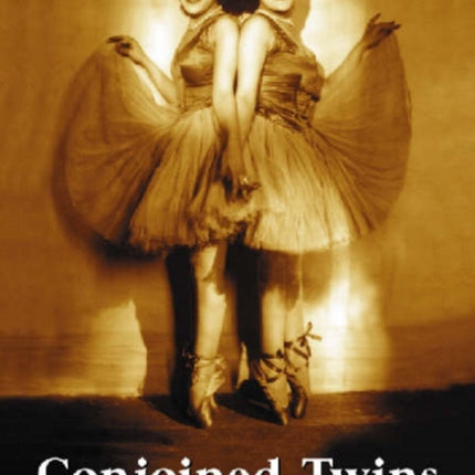 Conjoined Twins An Historical Biological and