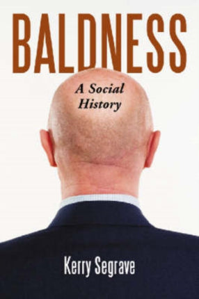 Baldness A Social History