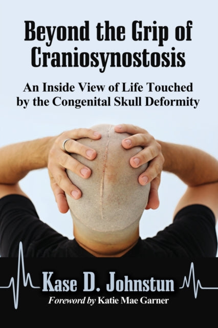 Beyond the Grip of Craniosynostosis An Inside