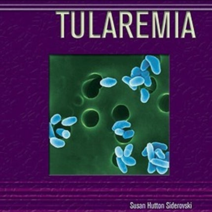 Tularemia