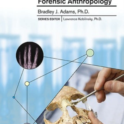Forensic Anthropology