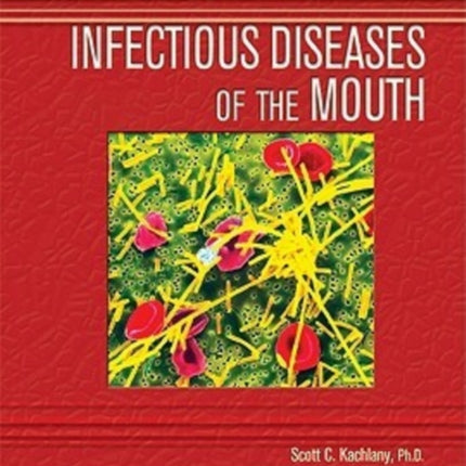 Infectious Diseases of the Mouth Deadly Diseases