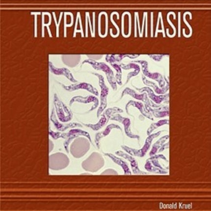 Trypanosomiasis