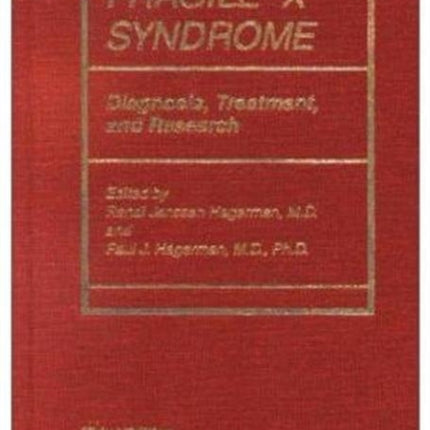 Fragile X Syndrome: Diagnosis, Treatment, and Research