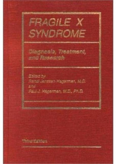 Fragile X Syndrome: Diagnosis, Treatment, and Research