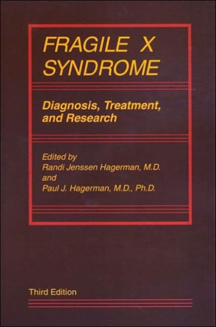 Fragile X Syndrome: Diagnosis, Treatment, and Research