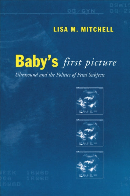 Babys First Picture