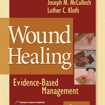 Wound Healing