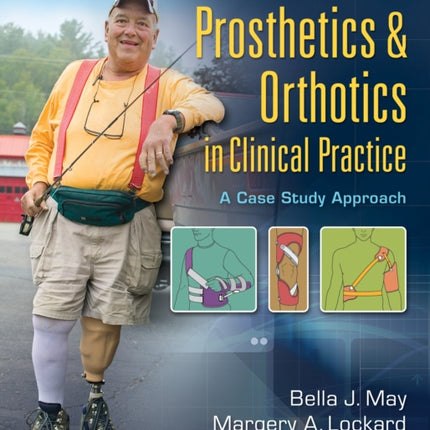 Prosthetics  Orthotics in Clinical Practice  A Case Study Approach