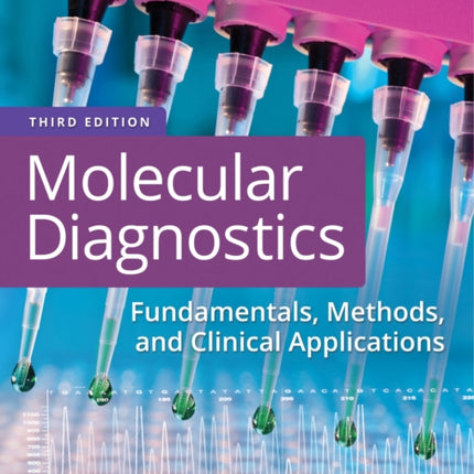 Molecular Diagnostics: Fundamentals, Methods, and Clinical Applications