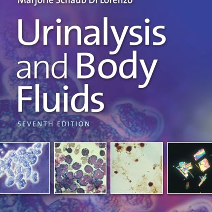 Urinalysis and Body Fluids