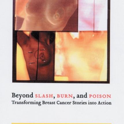 Beyond Slash Burn and Poison Transforming Breast Cancer Stories into Action