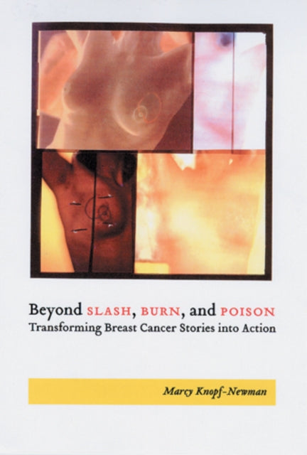 Beyond Slash Burn and Poison Transforming Breast Cancer Stories into Action