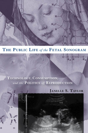 The Public Life of the Fetal Sonogram Technology