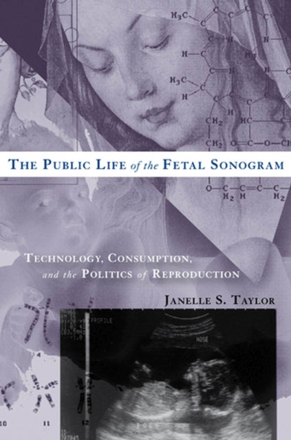 The Public Life of the Fetal Sonogram Technology