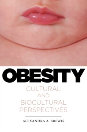 Obesity Cultural and Biocultural Perspectives Studies in Medical Anthropology