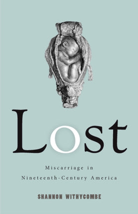 Lost  Miscarriage in NineteenthCentury America