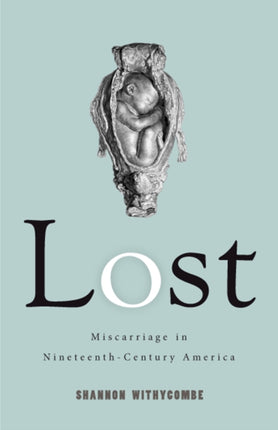Lost  Miscarriage in NineteenthCentury America