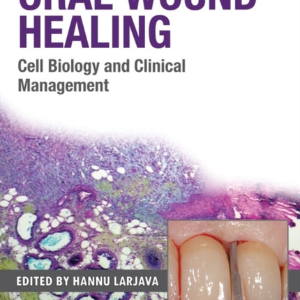 Oral Wound Healing
