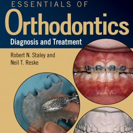 Essentials of Orthodontics