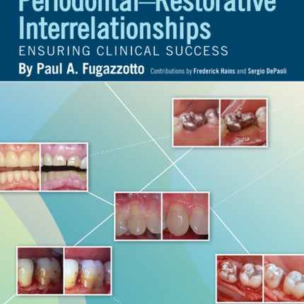 Periodontal-Restorative Interrelationships: Ensuring Clinical Success