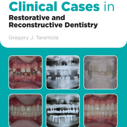 Clinical Cases in Restorative and Reconstructive Dentistry