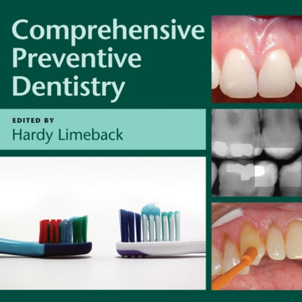 Comprehensive Preventive Dentistry