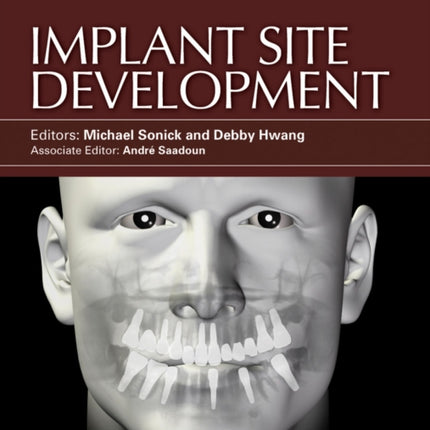 Implant Site Development