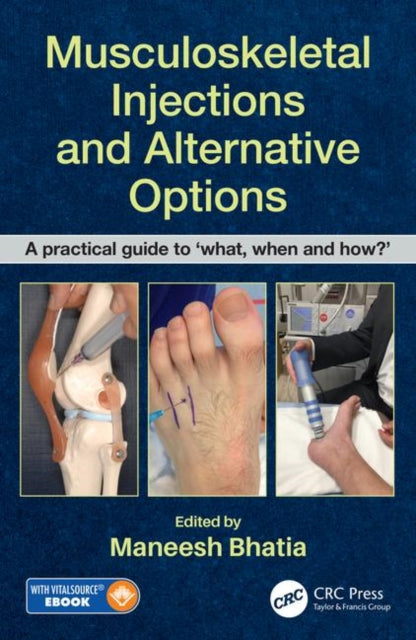 Musculoskeletal Injections and Alternative Options: A practical guide to 'what, when and how?'