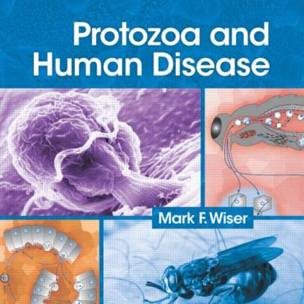 Protozoa and Human Disease