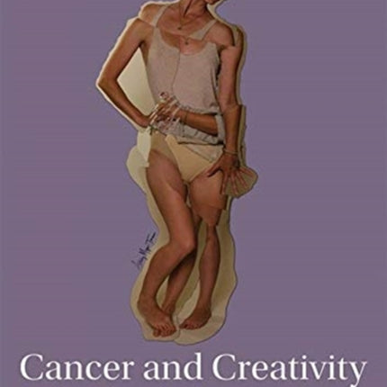 Cancer and Creativity: A Psychoanalytic Guide to Therapeutic Transformation