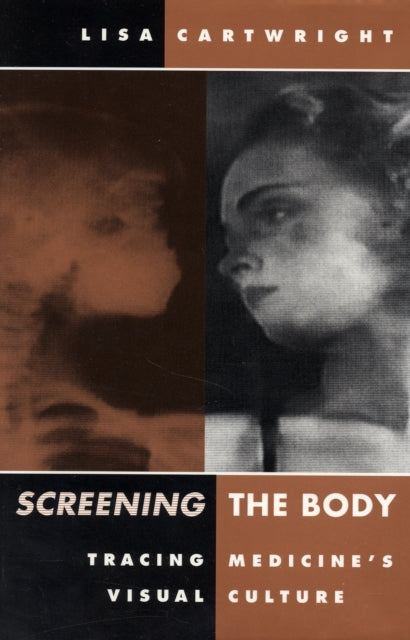 Screening The Body: Tracing Medicine’s Visual Culture