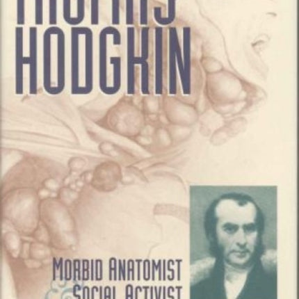 Thomas Hodgkin