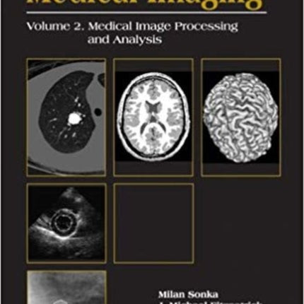 Handbook Of Medical Imaging, Volume 2: Medical Image Processing And Analysis